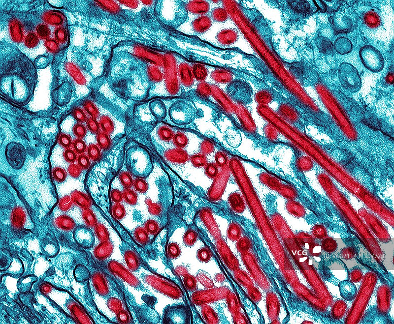 禽流感病毒（透射电镜）图片素材
