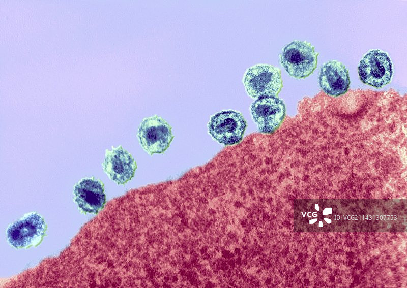 感染HIV的细胞，透射电镜图片素材