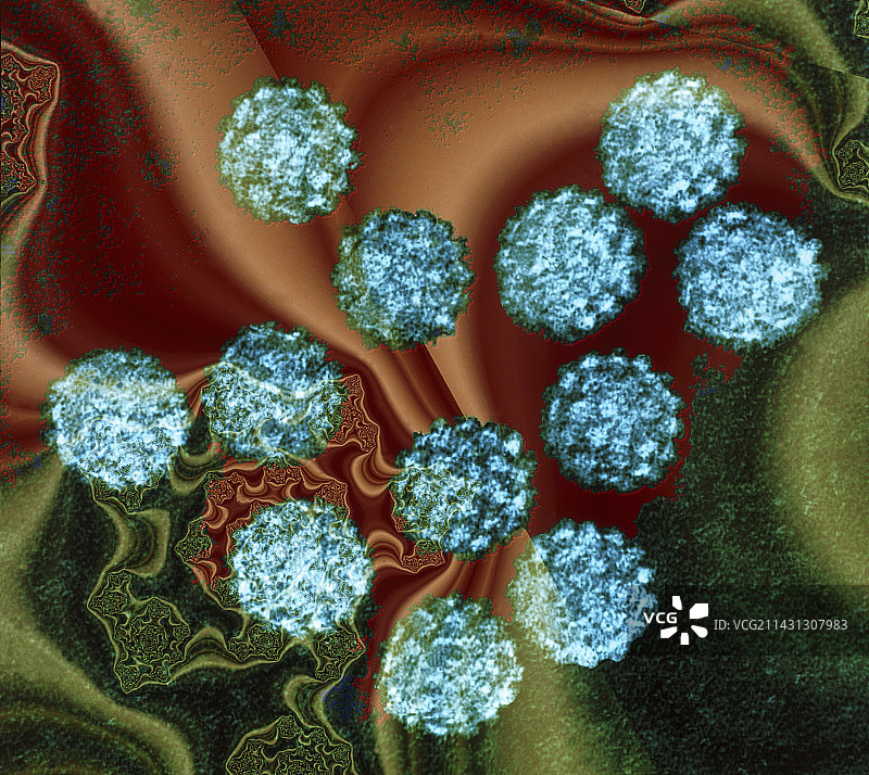 人乳头瘤病毒（TEM）图片素材