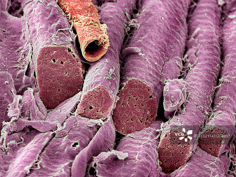 平滑肌，扫描电子显微镜图片素材