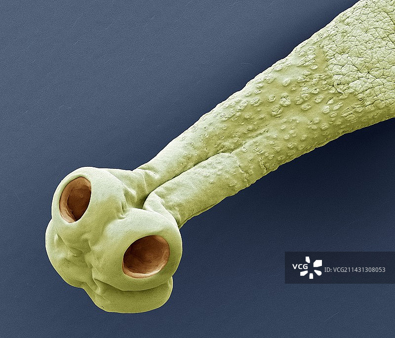 牛肉绦虫扫描电镜图图片素材