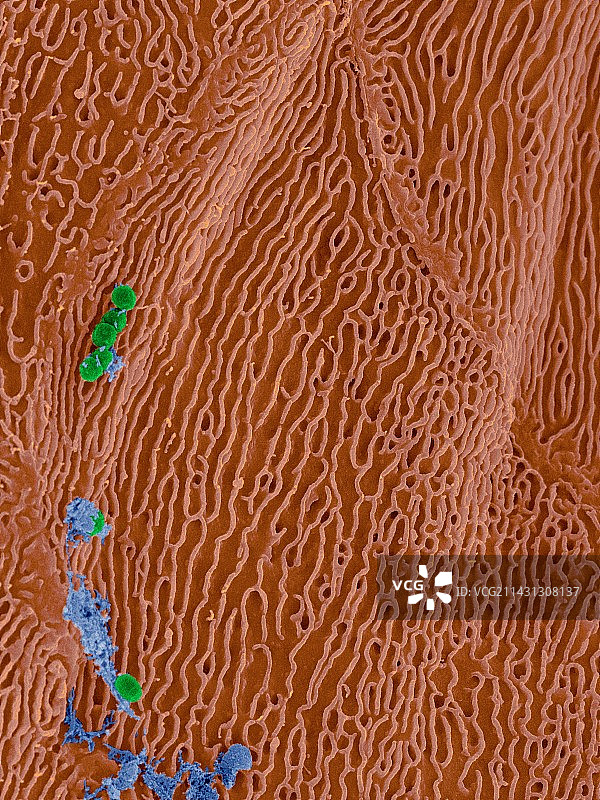 人舌乳头上的细菌，扫描电镜图图片素材