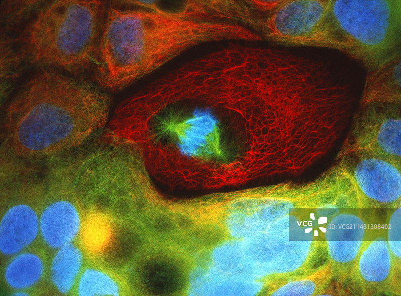 人结肠癌细胞的免疫荧光LM图片素材