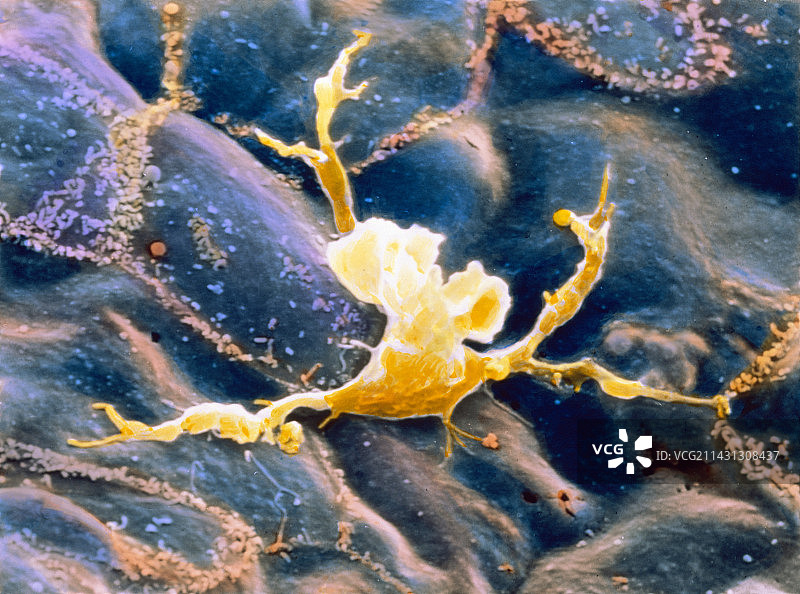 活化巨噬细胞的彩色扫描电镜图图片素材