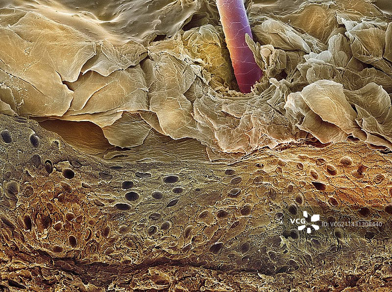 皮肤切面扫描电子显微镜图片素材