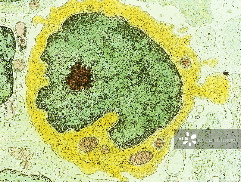 人类淋巴细胞的伪彩色扫描电镜图像图片素材