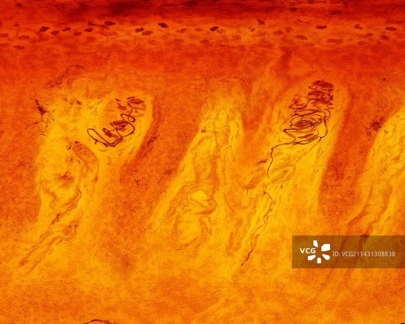 迈斯纳小体显微照片图片素材