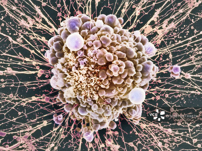 HeLa细胞死亡，扫描电子显微镜图片素材