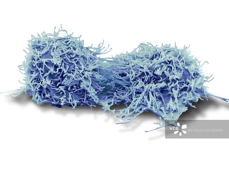 肝癌细胞分裂（扫描电镜）图片素材
