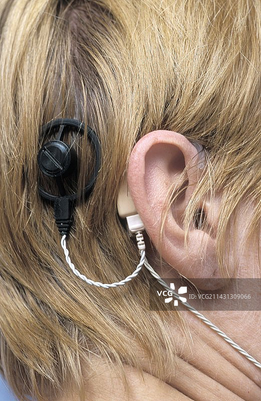 人工耳蜗图片素材