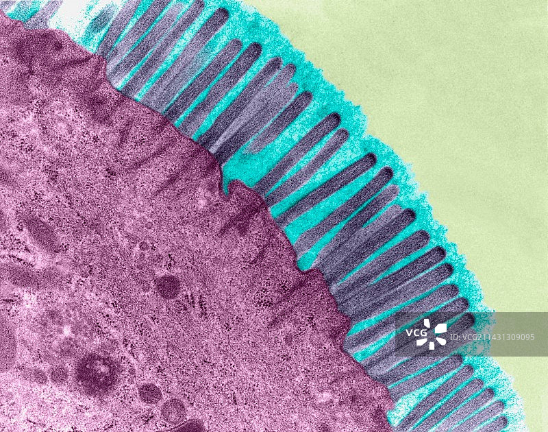 小肠微绒毛的透射电镜图图片素材
