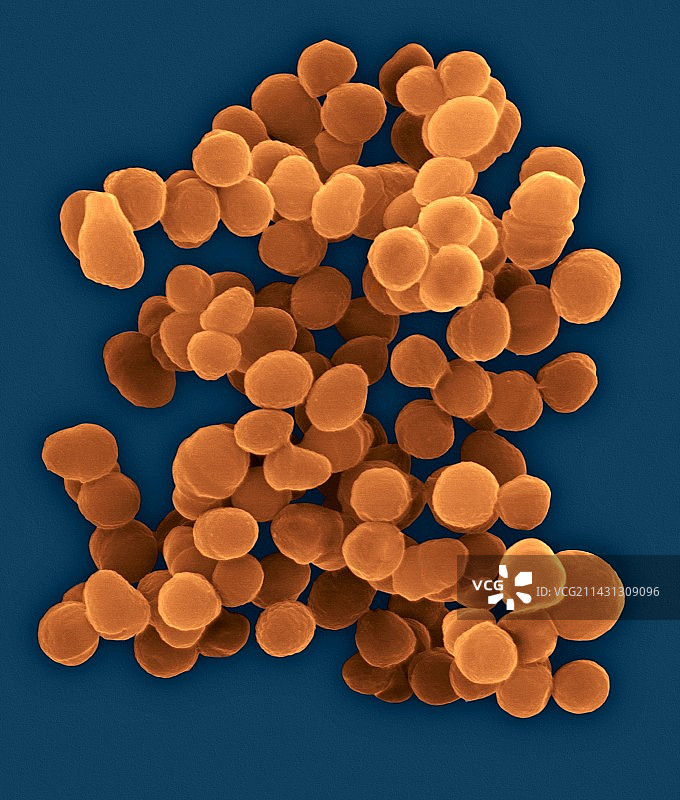 尿液气球菌，球状，原核生物，扫描电镜图片素材