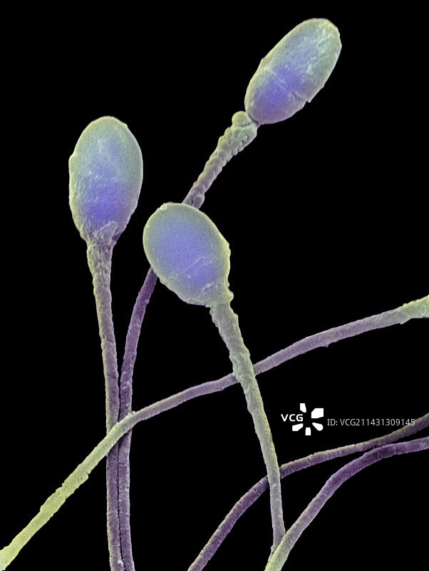 人类精子图片素材