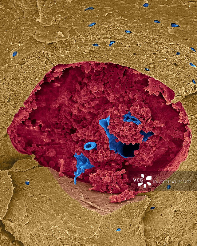 骨密质和骨髓扫描电镜图图片素材