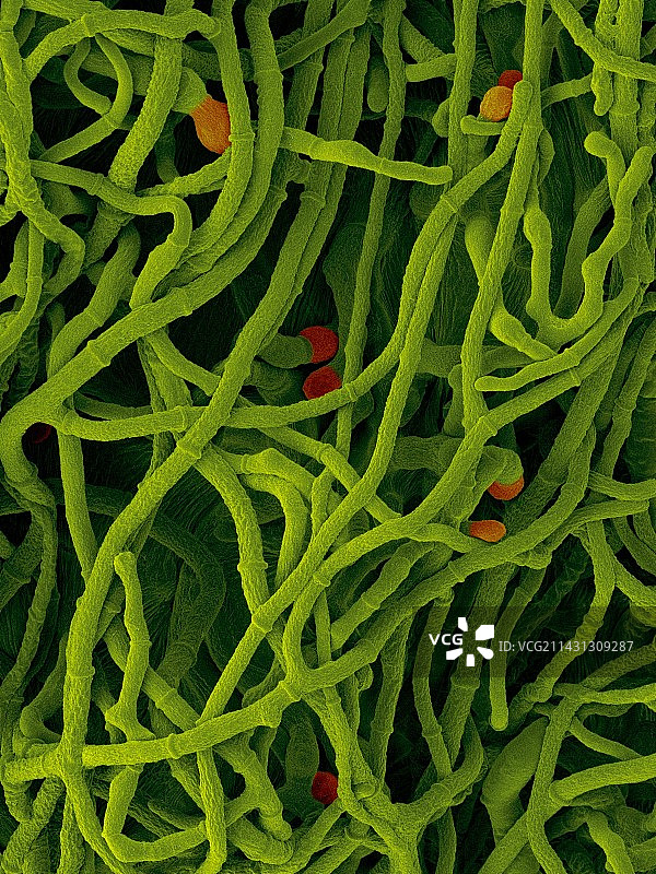 球毛壳菌菌丝和孢子，扫描电镜图图片素材