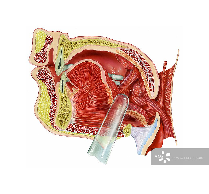 扁桃体图片素材