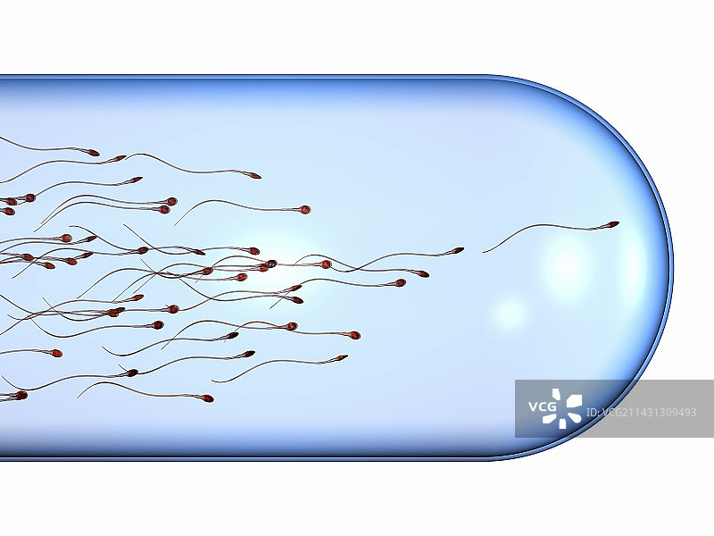 精子与屏障避孕插图图片素材