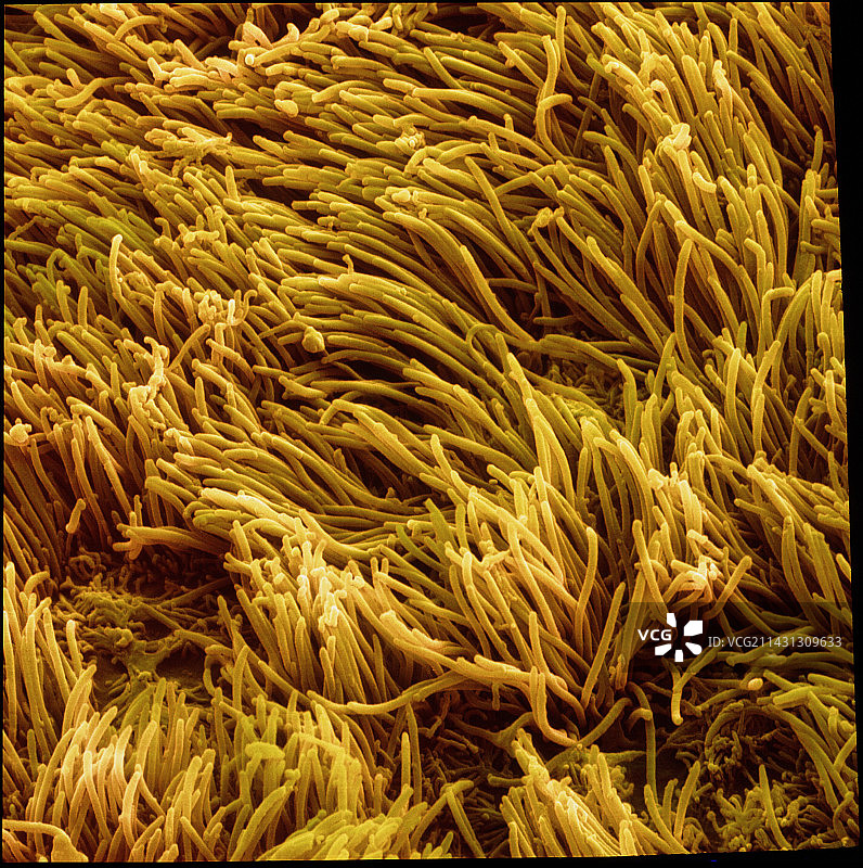 肺细支气管内壁的彩色扫描电镜图图片素材