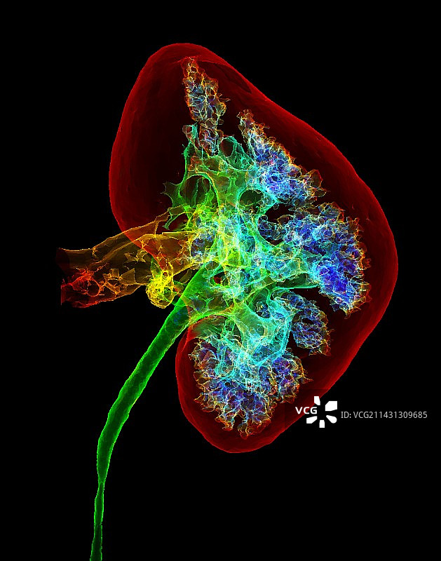 肾脏3D CT扫描图片素材