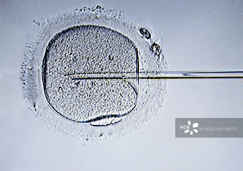 试管婴儿治疗图片素材