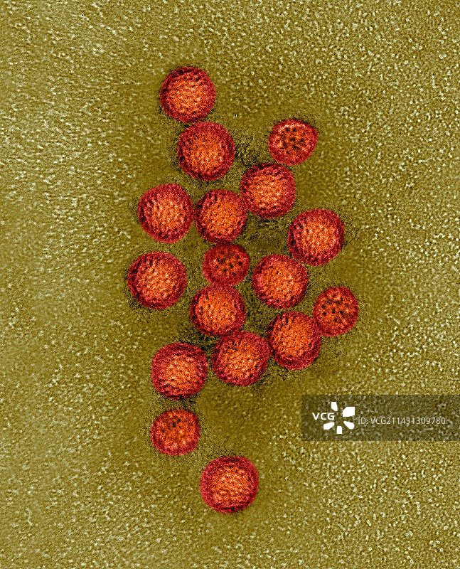 诺如病毒，TEM图片素材