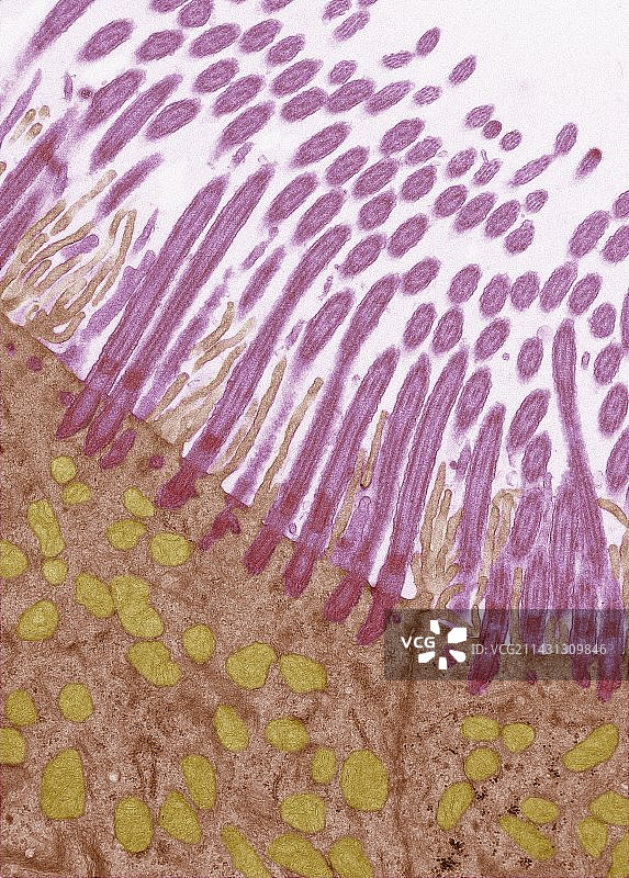 气管内壁，TEM图片素材