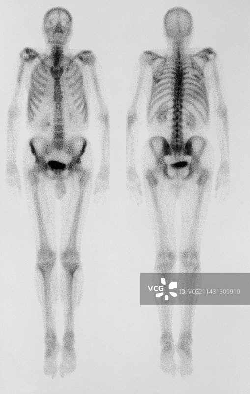 骷髅伽马扫描图片素材
