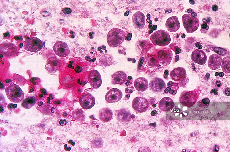 福氏耐格里阿米巴变形虫感染浅显显微照片图片素材