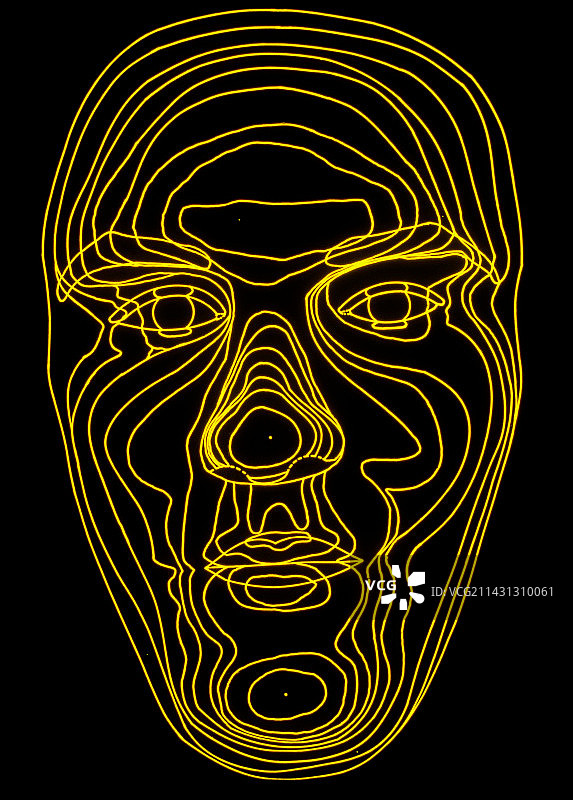 肢端肥大症患者的面部轮廓图图片素材