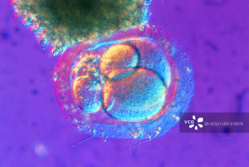 受精人卵细胞的显微照片图片素材