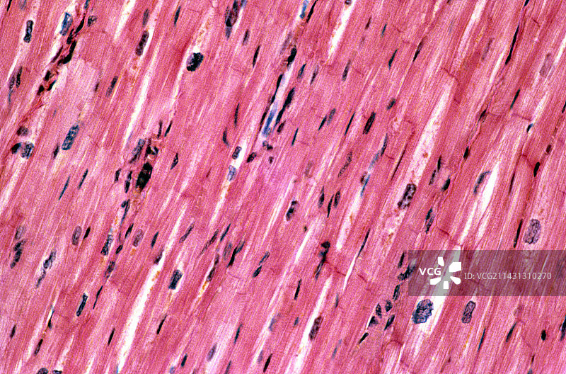 心肌的光学显微照片图片素材