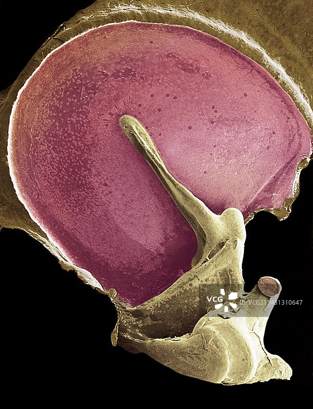 耳膜，扫描电镜图片素材