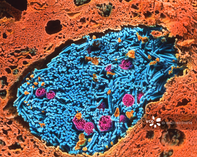 炭疽杆菌图片素材