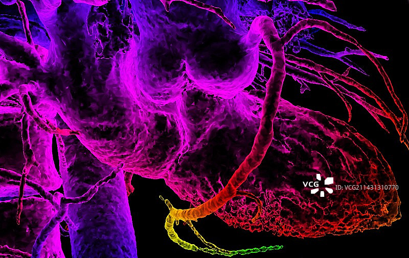 心血管系统CT扫描图片素材