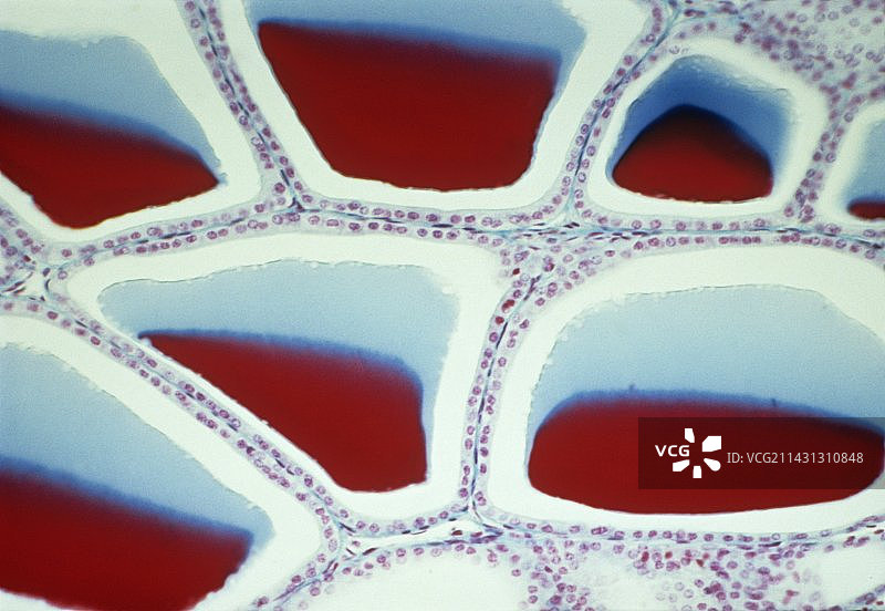 甲状腺滤泡显微照片图片素材