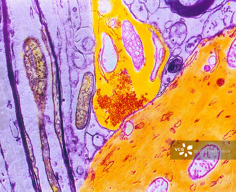 神经突触的透射电镜图片素材
