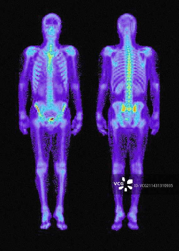 骷髅伽马扫描图片素材