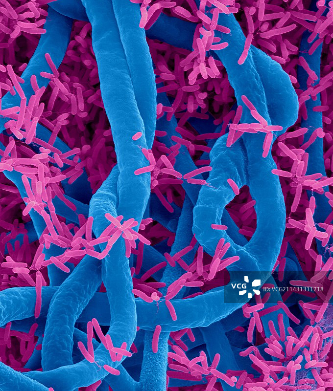 假单胞菌和腐霉菌，扫描电镜图片素材