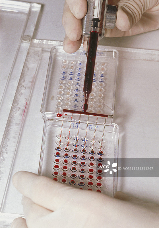 疾病抗体ELISA血液检测图片素材