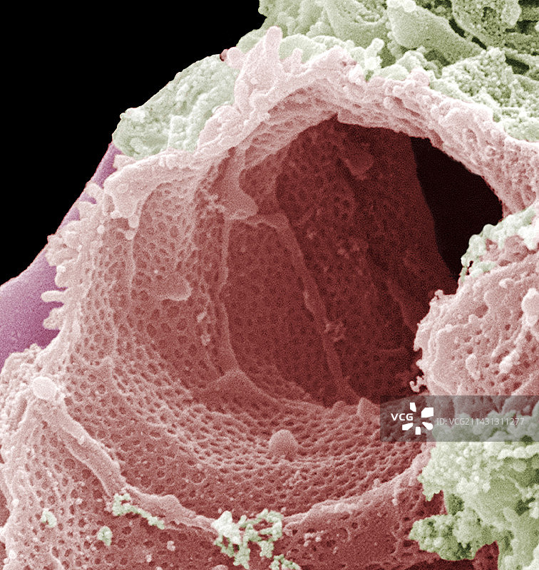 肾脏毛细血管扫描电镜图图片素材