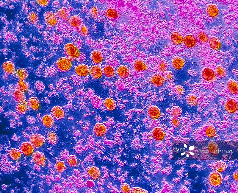HTLV-1病毒透射电镜图图片素材