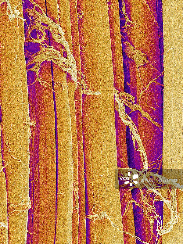 骨骼肌纤维图片素材