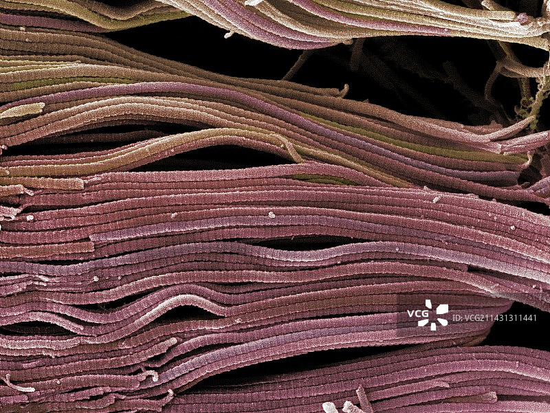 胶原蛋白束，扫描电子显微镜图图片素材