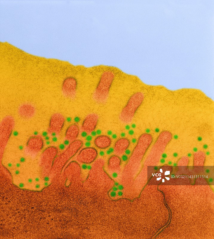 鼻病毒，普通感冒的病原体，透射电镜图片素材