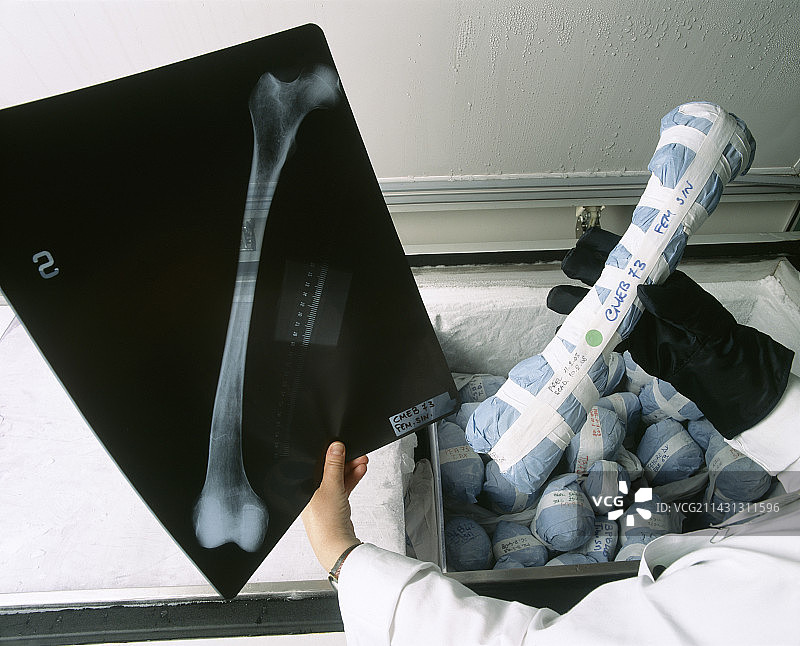 骨库捐献者筛查图片素材