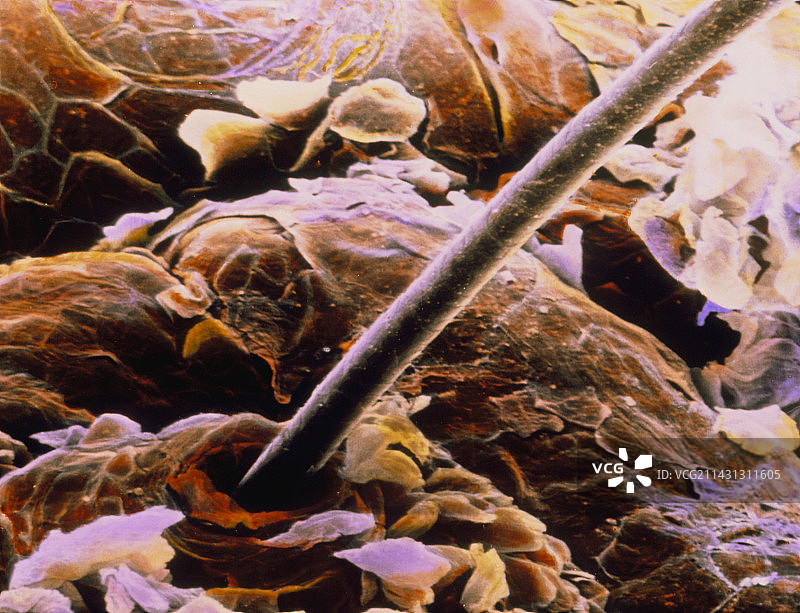 从皮肤突出的毛发图片素材