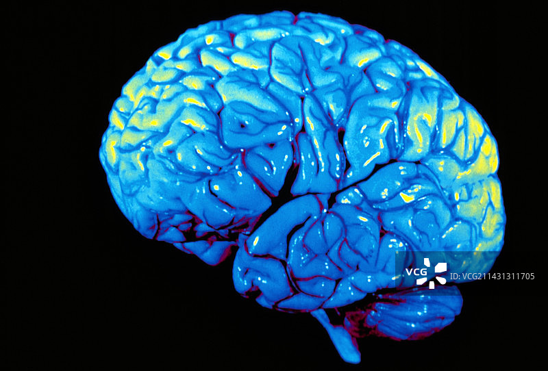 大脑侧面的彩色3D核磁共振扫描图图片素材