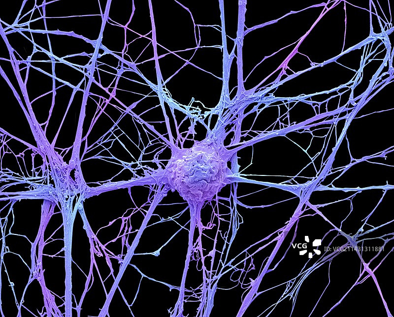 神经元扫描电镜图图片素材