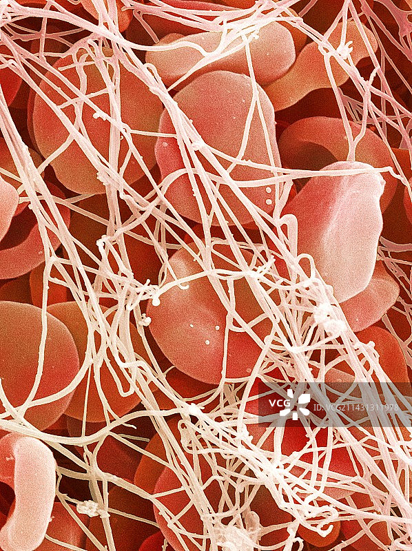 血栓扫描电镜图片素材