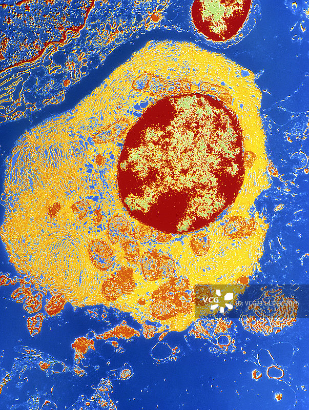淋巴结浆细胞的彩色透射电镜图图片素材